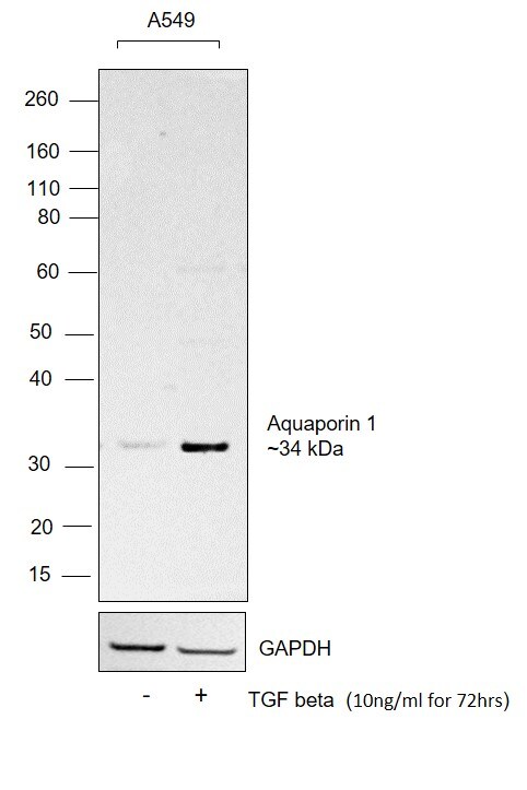 Human TGF-beta 1 Protein in Functional assay (FN)