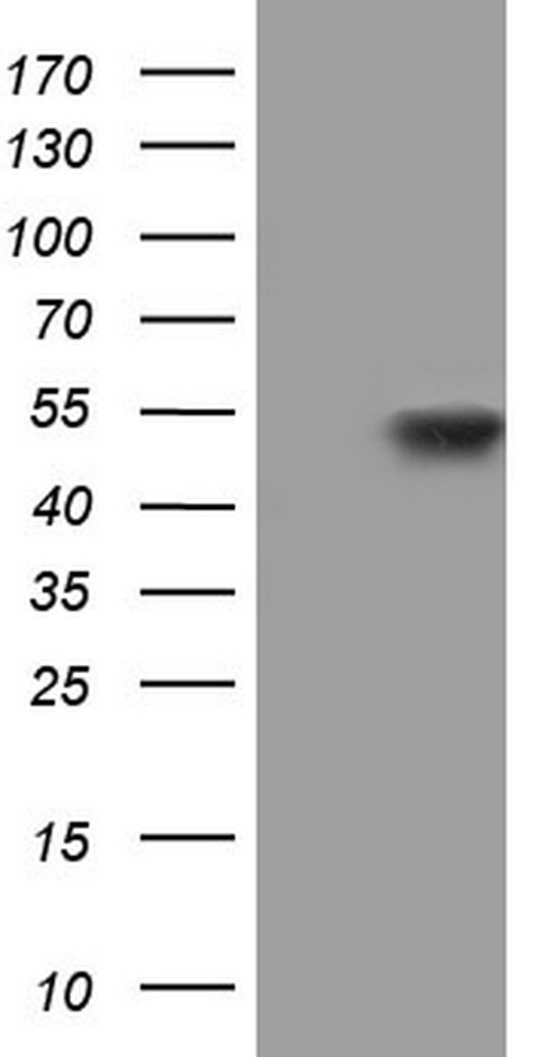 PPP1R8 Antibody in Western Blot (WB)