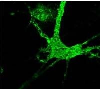 PPP1R9A Antibody in Immunocytochemistry (ICC/IF)