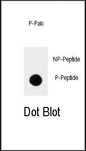 Phospho-TrkA (Tyr791) Antibody in Dot blot (DB)