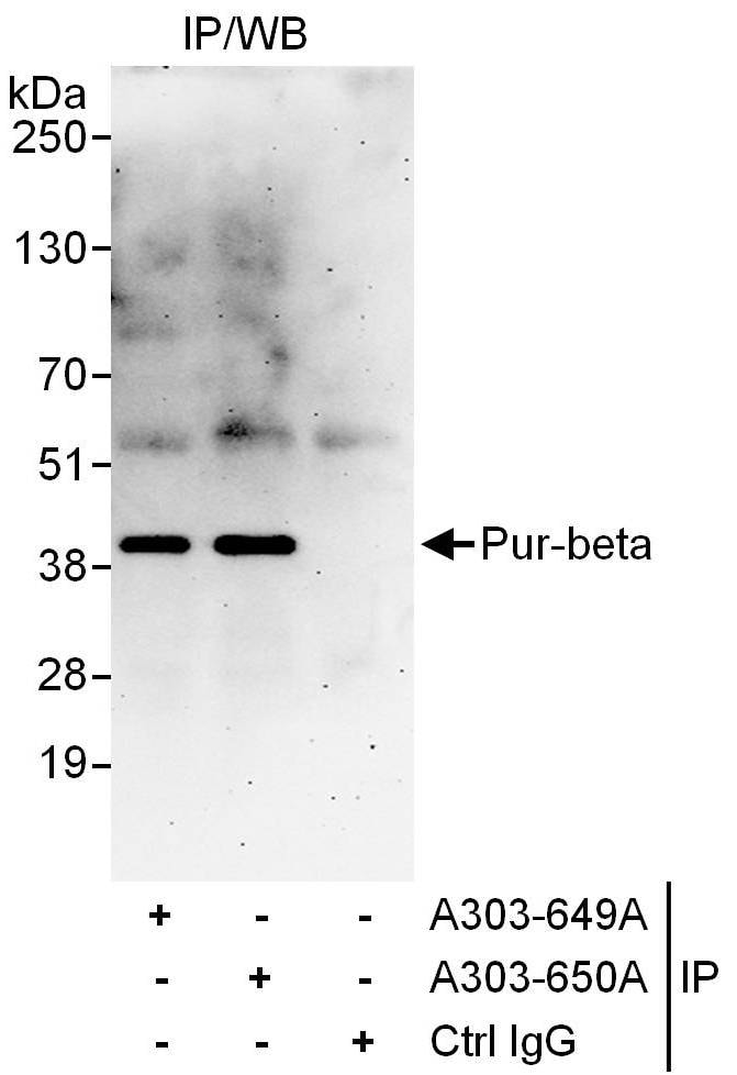 Pur-beta Antibody in Immunoprecipitation (IP)