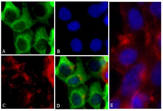 6x-His Tag Antibody (R930-25)