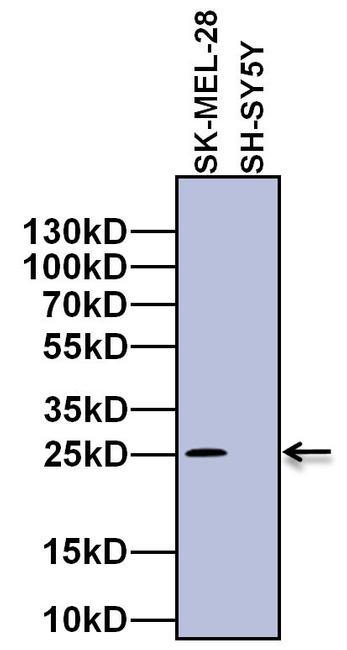 RAB27A Antibody in Western Blot (WB)