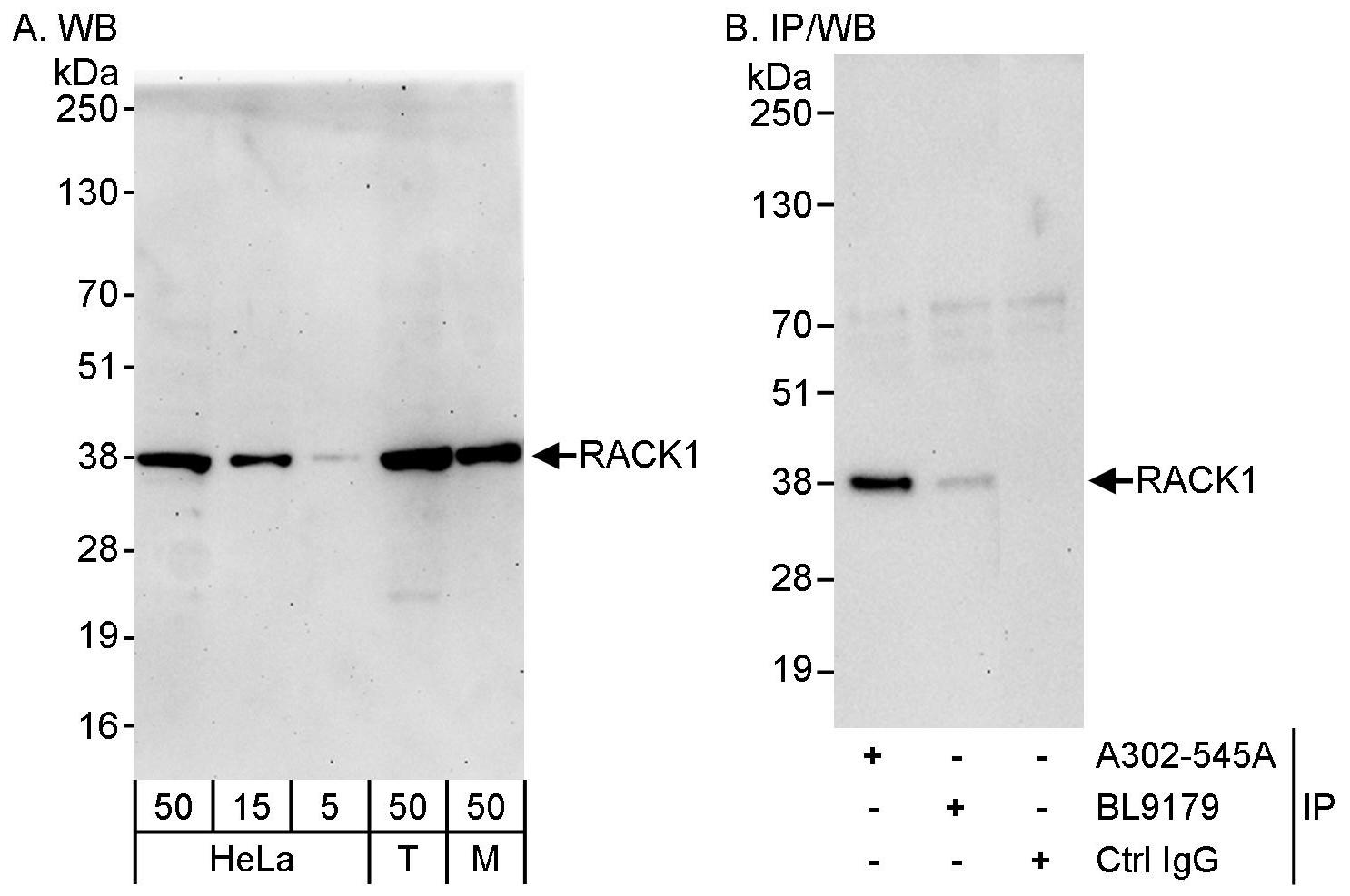 RACK1 Antibody (A302-545A)