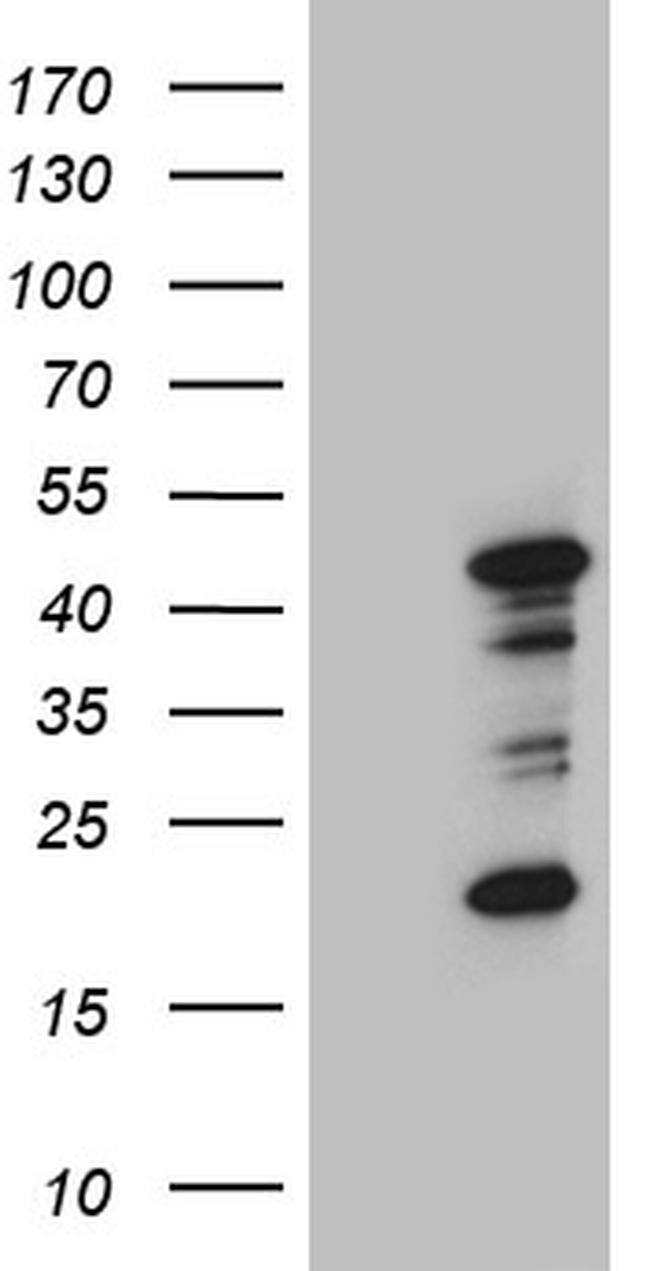 RAGE Antibody (TA810801)