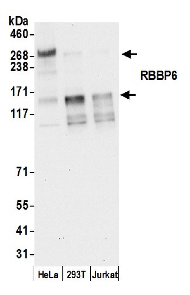 RBBP6 Antibody in Western Blot (WB)