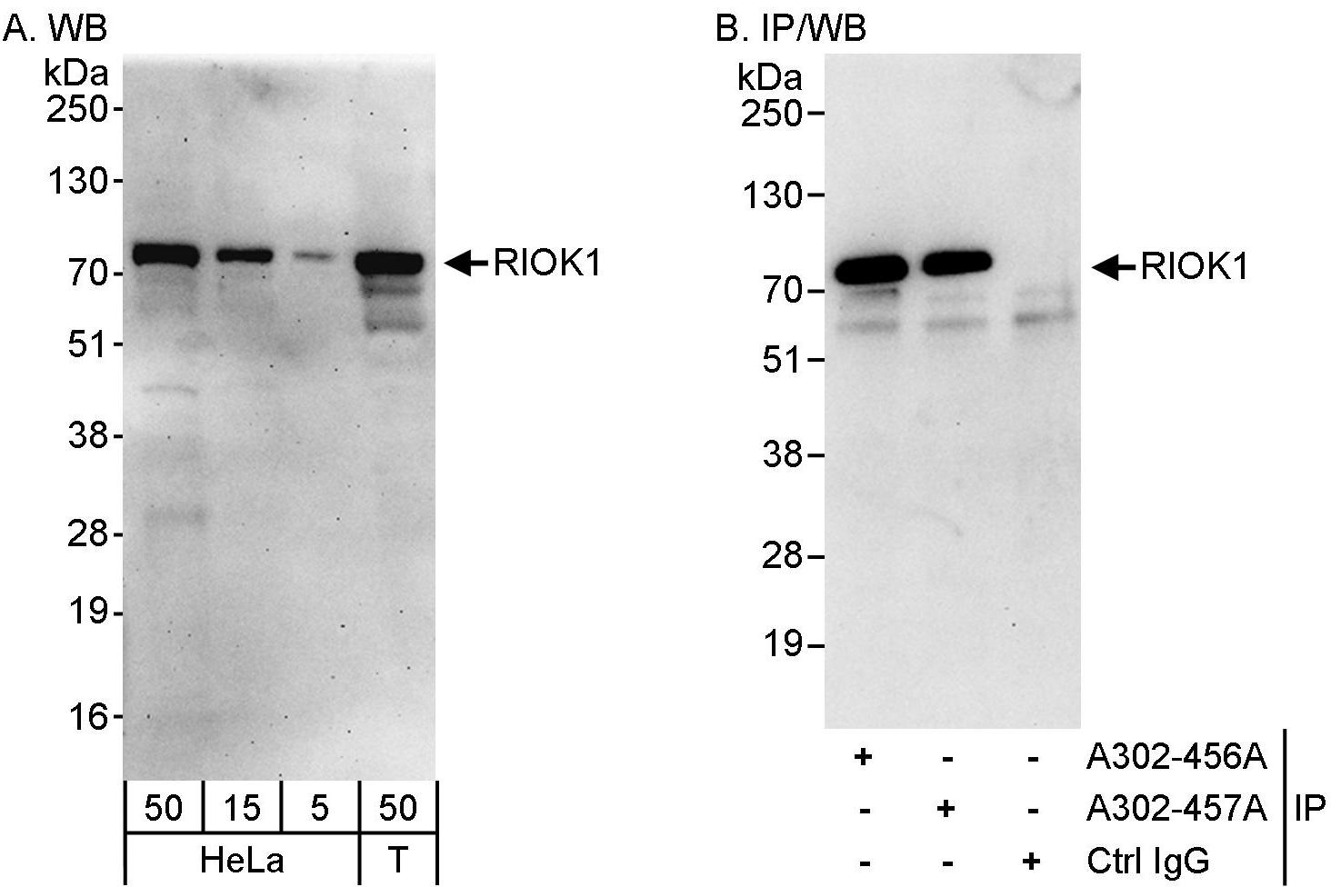 RIOK1 Antibody in Western Blot (WB)