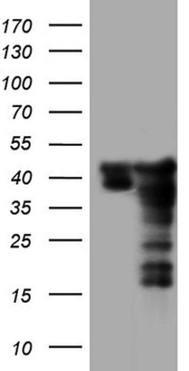 SAE1 Antibody in Western Blot (WB)