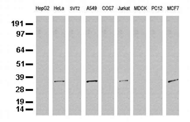 SDCBP Antibody in Western Blot (WB)