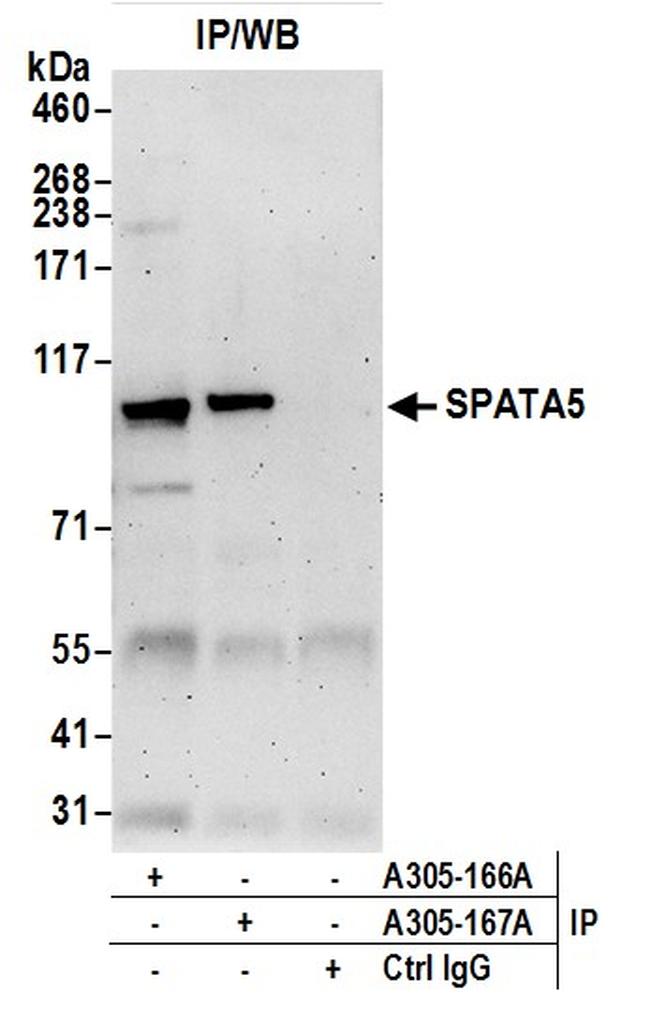 immunoprecipitation western blot immunoprecipitation western blot