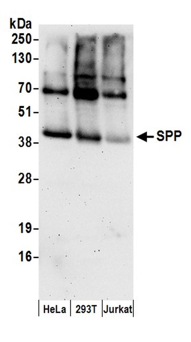 SPP Antibody in Western Blot (WB)
