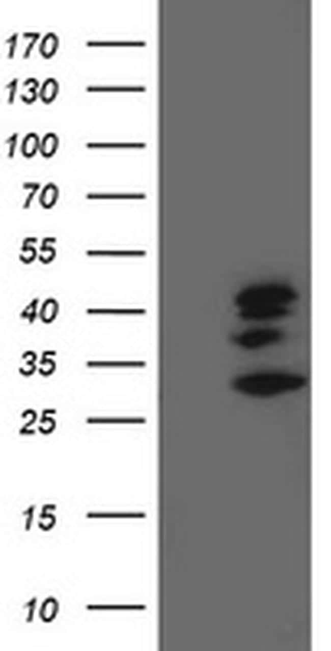 SSR1 Antibody (TA503267)