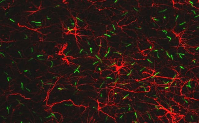 SSTR3 Antibody in Immunocytochemistry (ICC/IF)