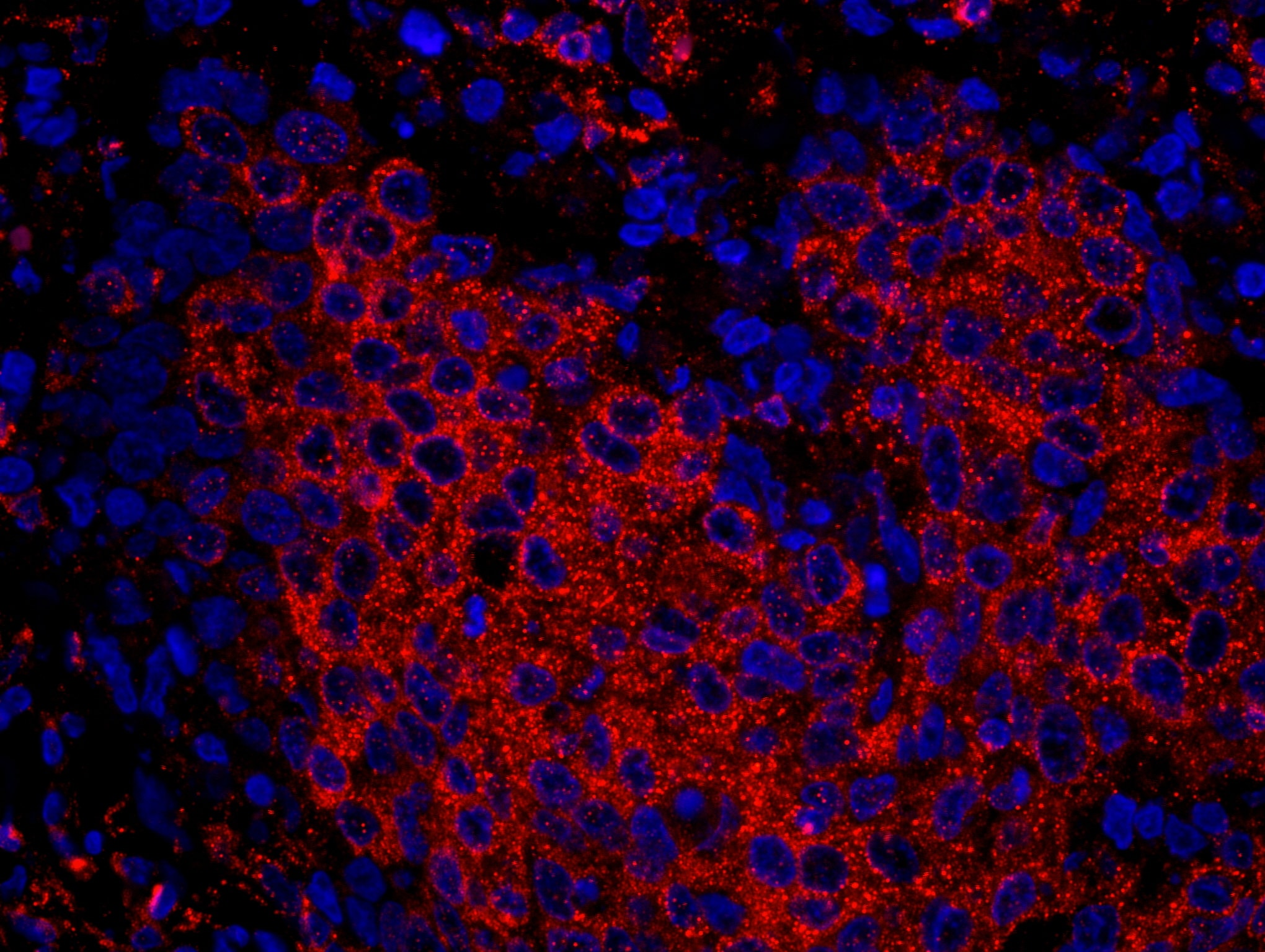 STUB1/CHIP Antibody (IHC-00345)