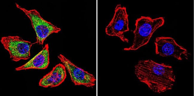 Sodium/Calcium Exchanger Antibody in Immunocytochemistry (ICC/IF)