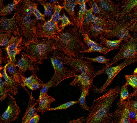 ATP1A1 Antibody in Immunocytochemistry (ICC/IF)