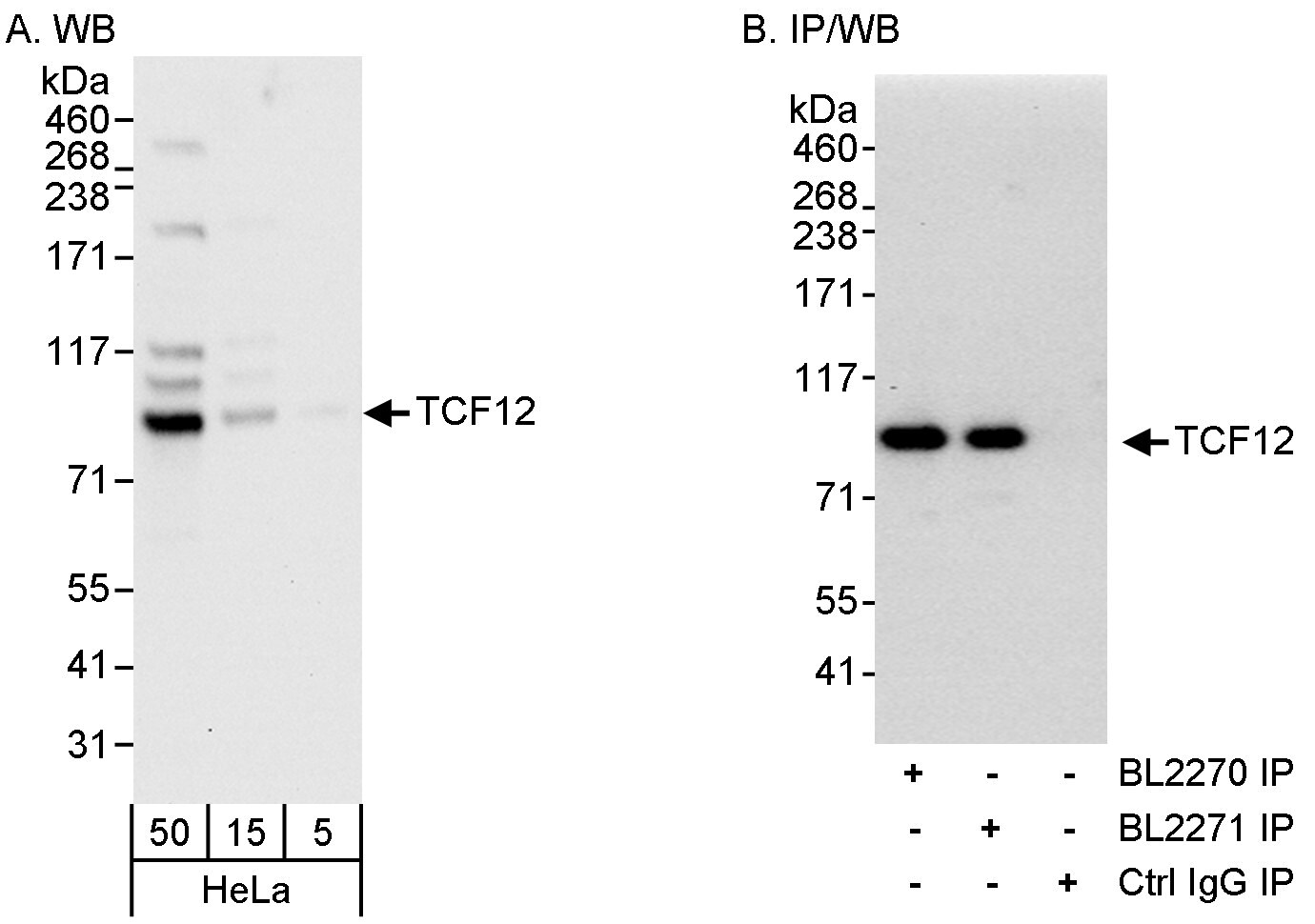 TCF12 Antibody (A300-754A)