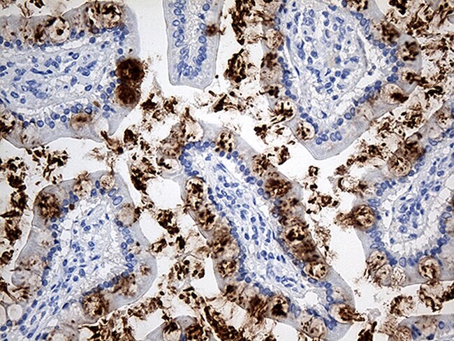TFF1 Monoclonal Antibody (OTI1A4), TrueMAB™