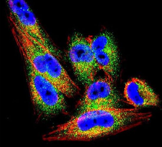 TIMP1 Antibody (PA5-13668)