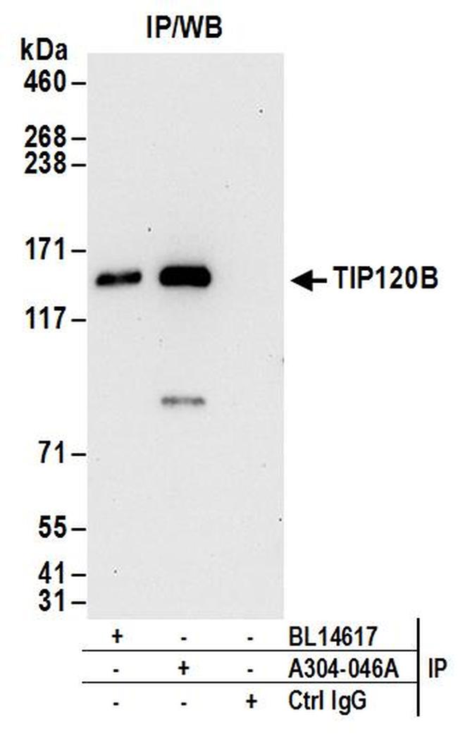 TIP120B Antibody in Western Blot (WB)