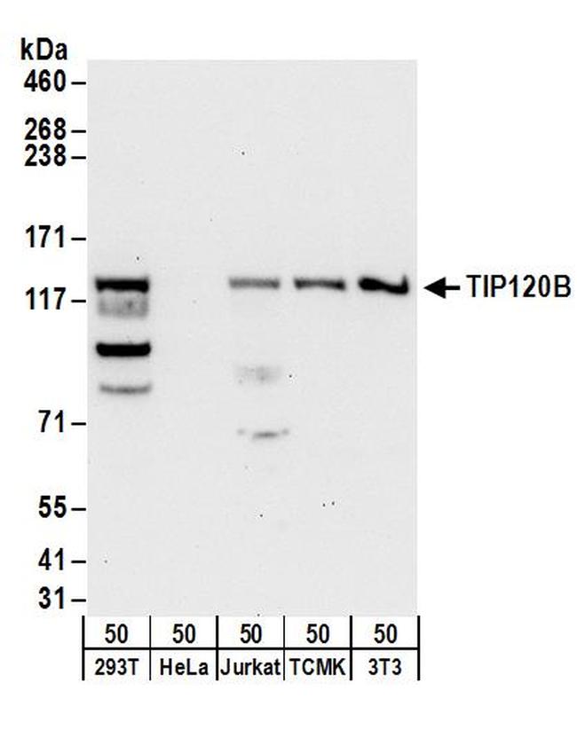 TIP120B Antibody in Western Blot (WB)