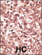 TLR6 Antibody in Immunohistochemistry (IHC)