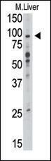 TLR6 Antibody in Western Blot (WB)