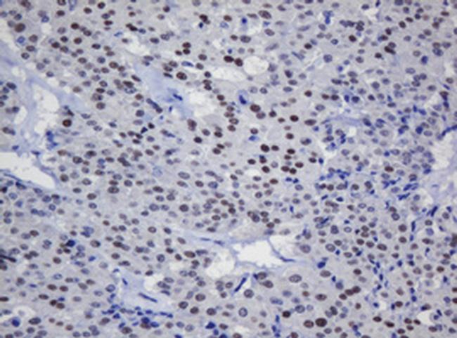 TRMT2A Antibody in Immunohistochemistry (Paraffin) (IHC (P))