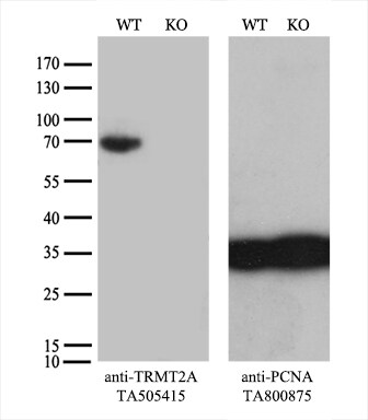 TRMT2A Antibody