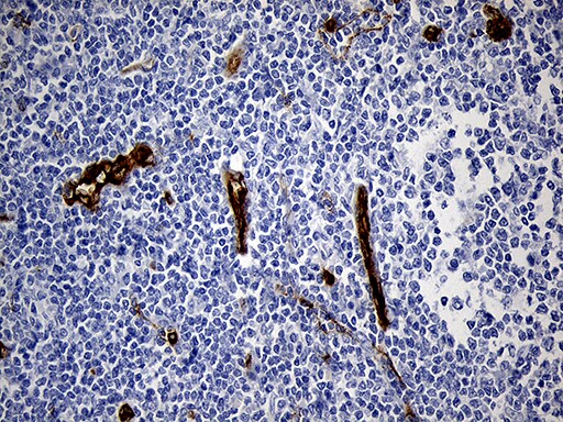 Tspan7 Antibody Ta811638