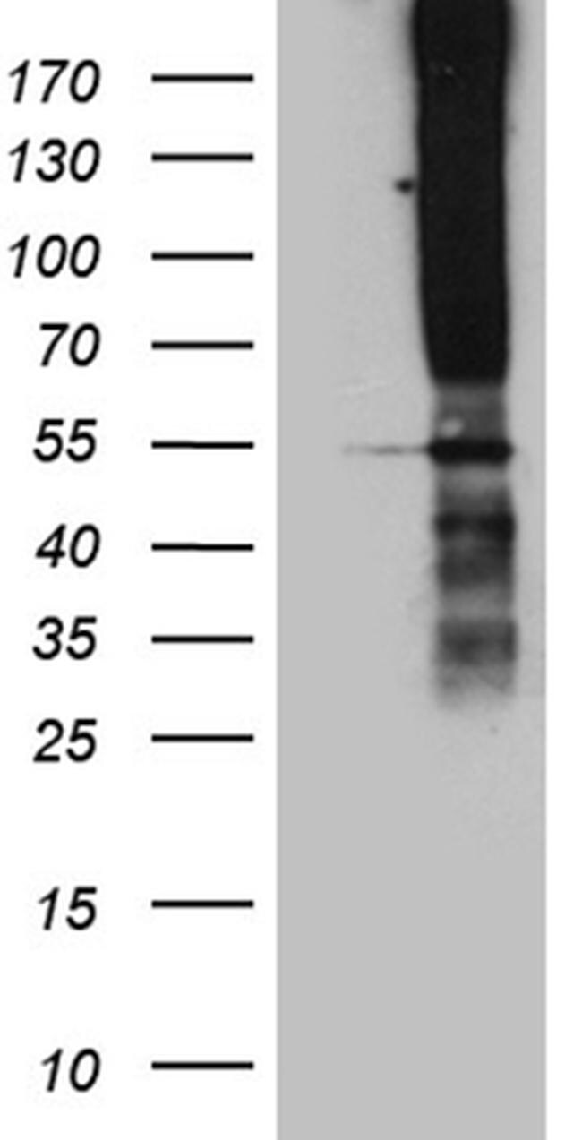 Tspan7 Antibody Ta811638