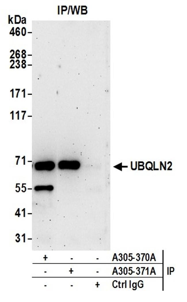 UBQLN2 Antibody (A305-370A)