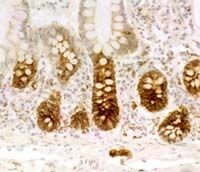 VIPR1 Antibody in Immunohistochemistry (IHC)