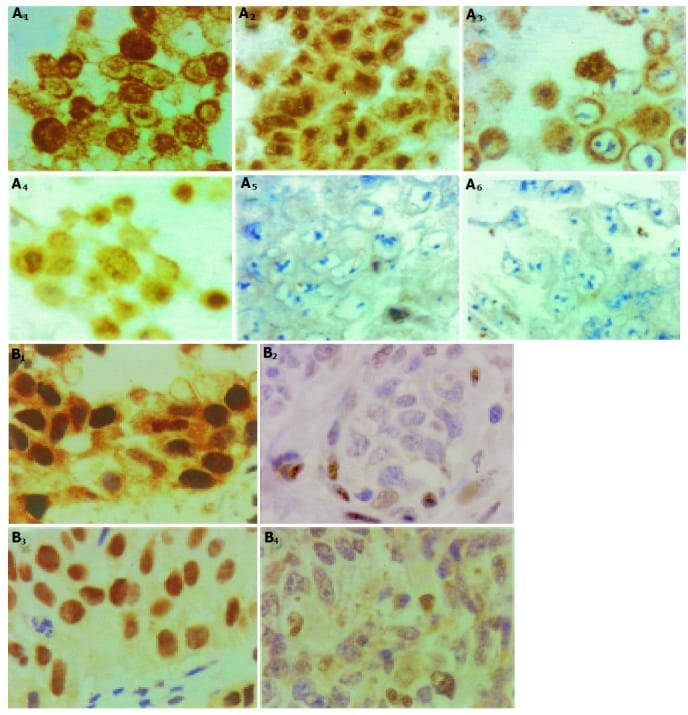 Glucocorticoid Receptor Antibody in Immunohistochemistry (Paraffin) (IHC (P))