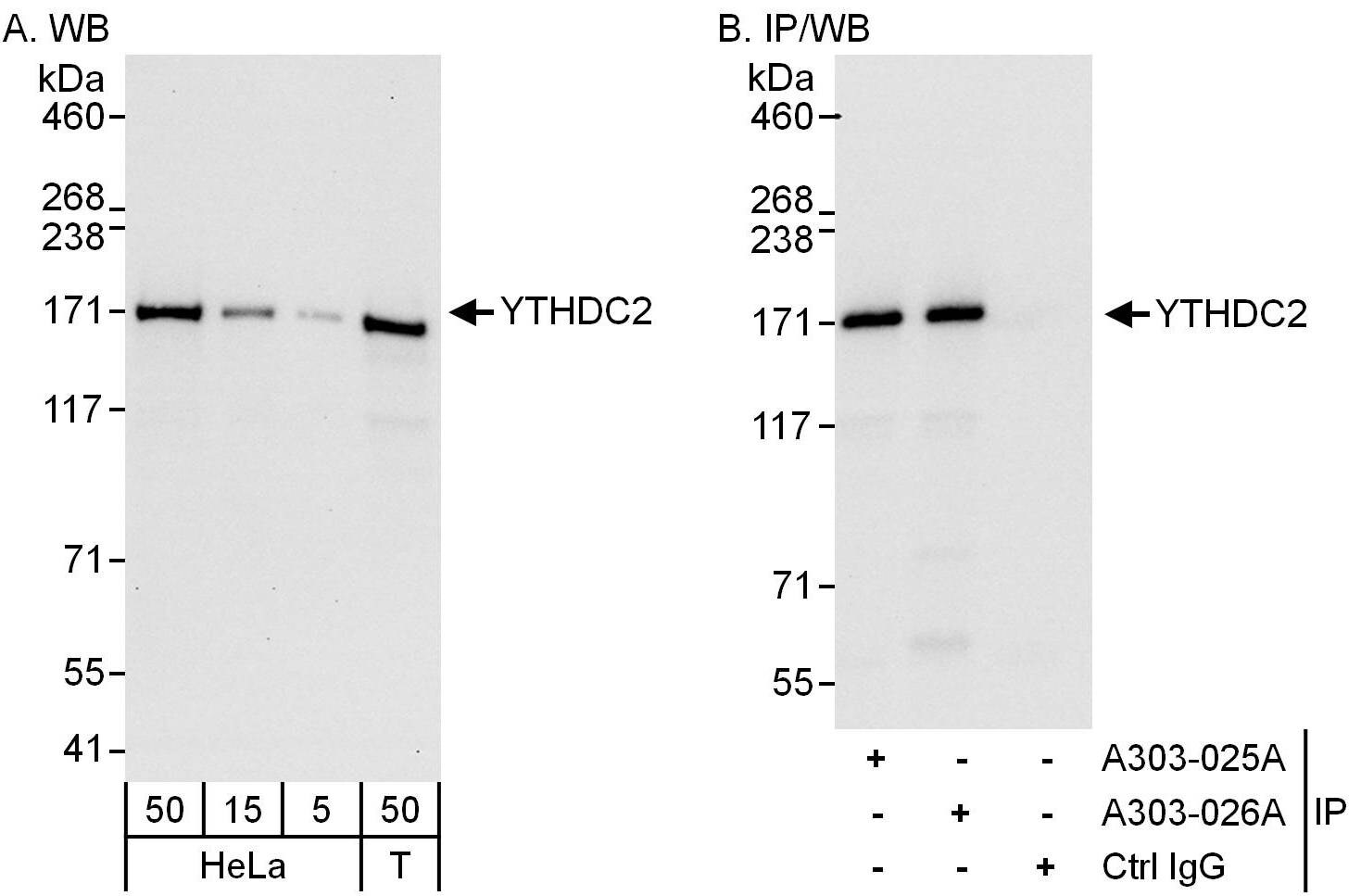 YTHDC2 Antibody (A303-026A)