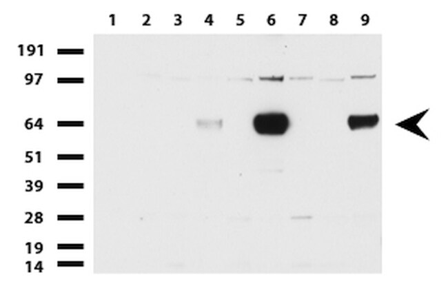 ZSCAN18 Antibody in Western Blot (WB)