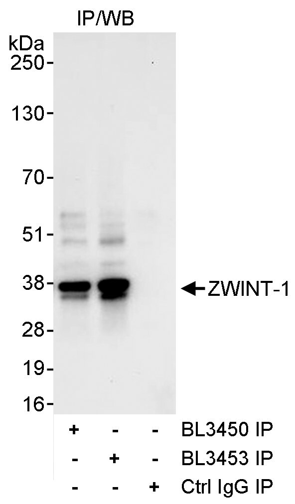ZWINT-1 Antibody in Immunoprecipitation (IP)