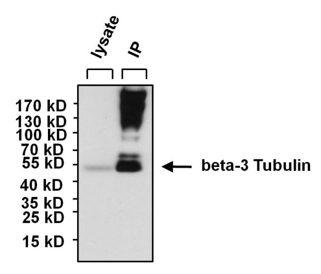 beta-3 Tubulin Antibody in Immunoprecipitation (IP)