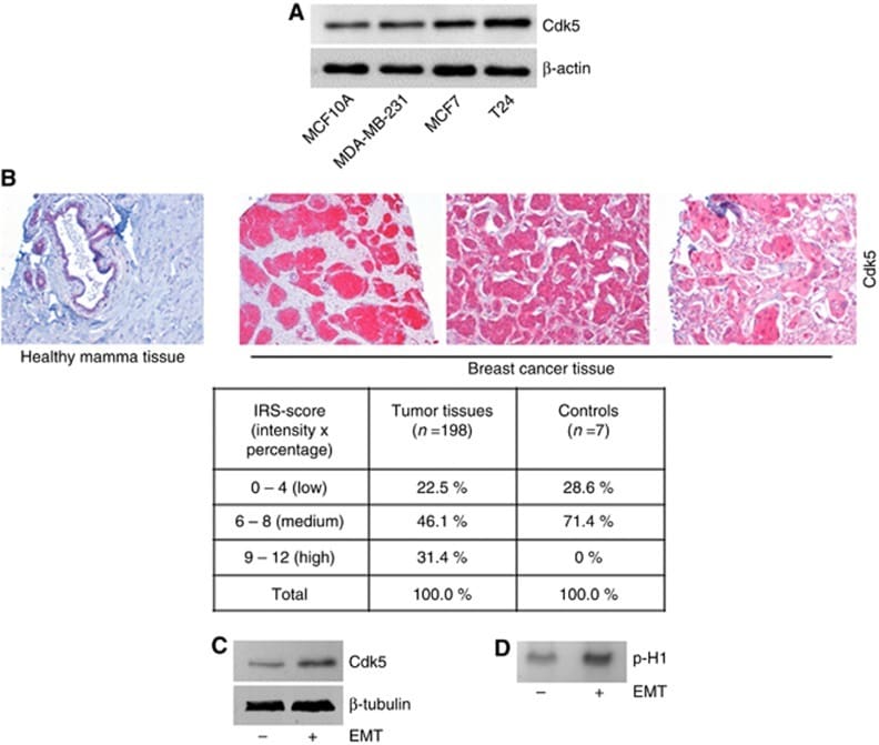 CDK5 Antibody in Western Blot, Immunohistochemistry (Paraffin) (WB, IHC (P))