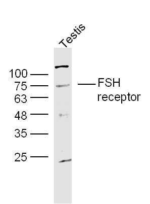 FSH receptor Antibody in Western Blot (WB)
