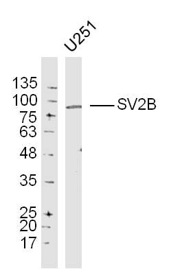 Sv2b Antibody Bs 11365r