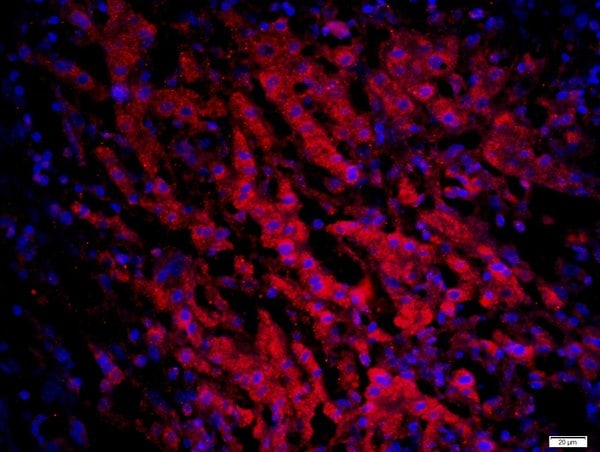 CCR6/CD196 Antibody (BS-1542R)