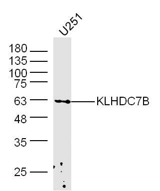 KLHDC7B Antibody (BS-16761R)