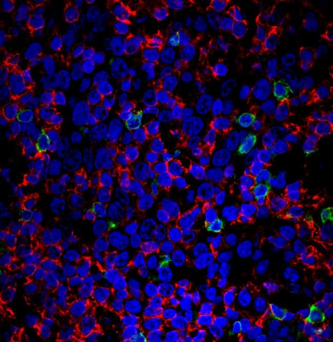 CD20 Antibody (PA1-37312)