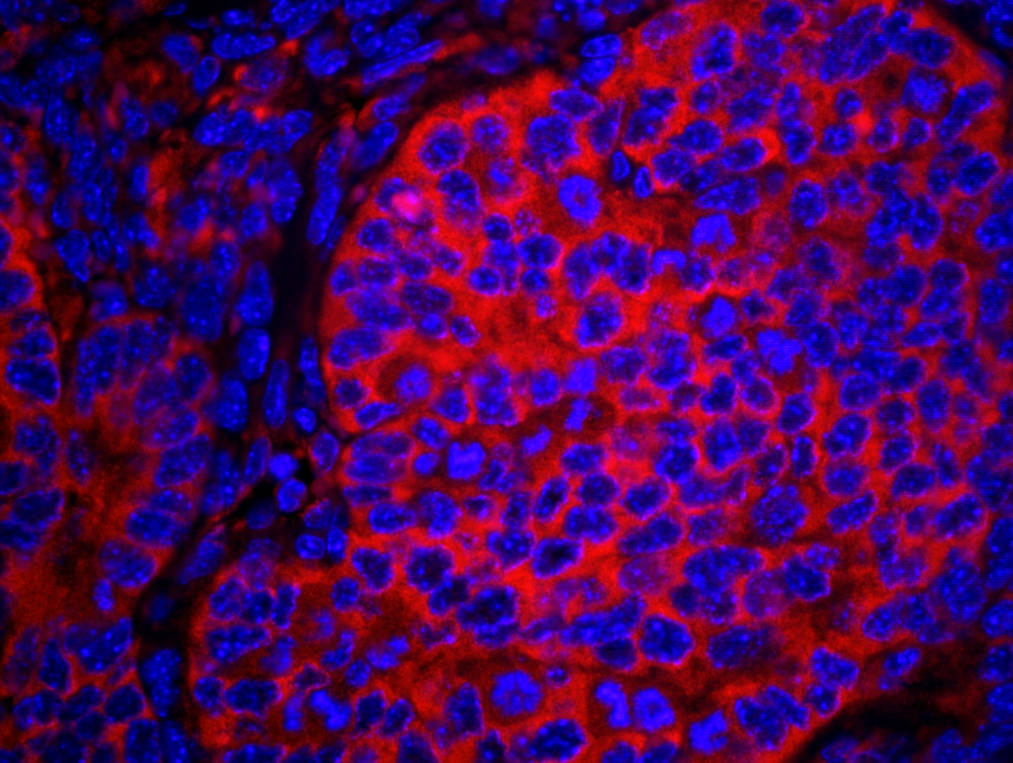 Eif2alpha Eif2s1 Antibody (ihc-00456)