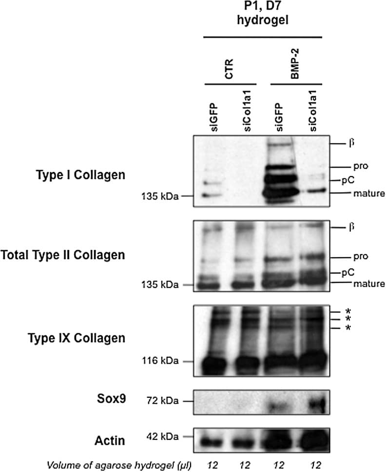 Collagen Ii Antibody Ma5 12789 7112