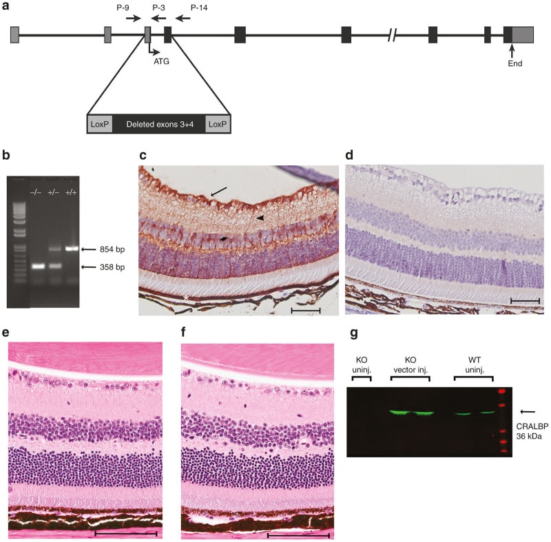 CRALBP Antibody in Immunohistochemistry (IHC)