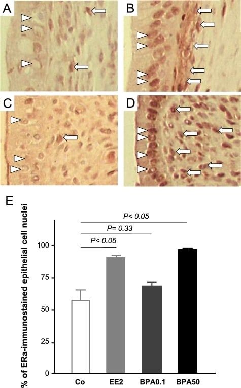 Estrogen Receptor beta Antibody in Immunohistochemistry (IHC)