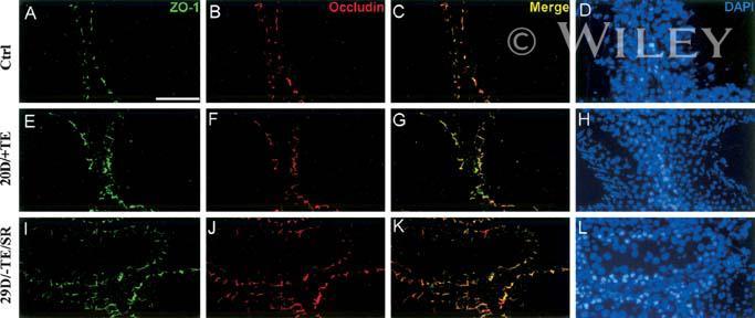 ZO 1 Antibody FITC 33 9111 ZO 1 Antibody FITC 33 9111
