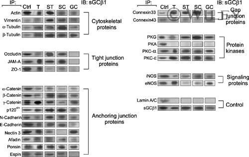 gamma Catenin Antibody in Immunoprecipitation (IP)